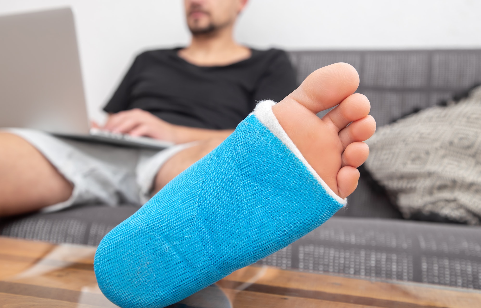 Close up of male foot in plaster cast with blue splint.