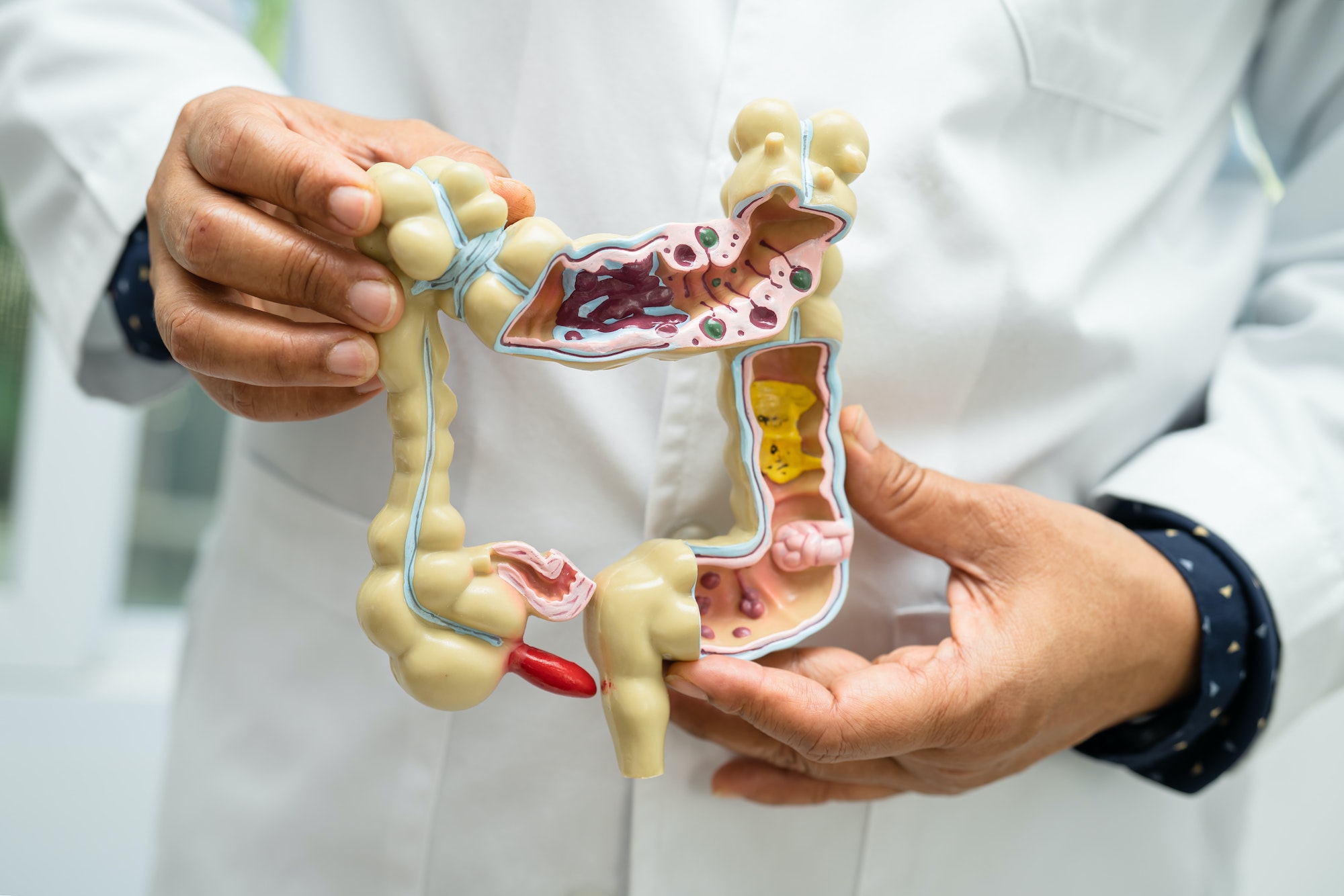 Intestine, appendix and digestive system, doctor holding anatomy model.